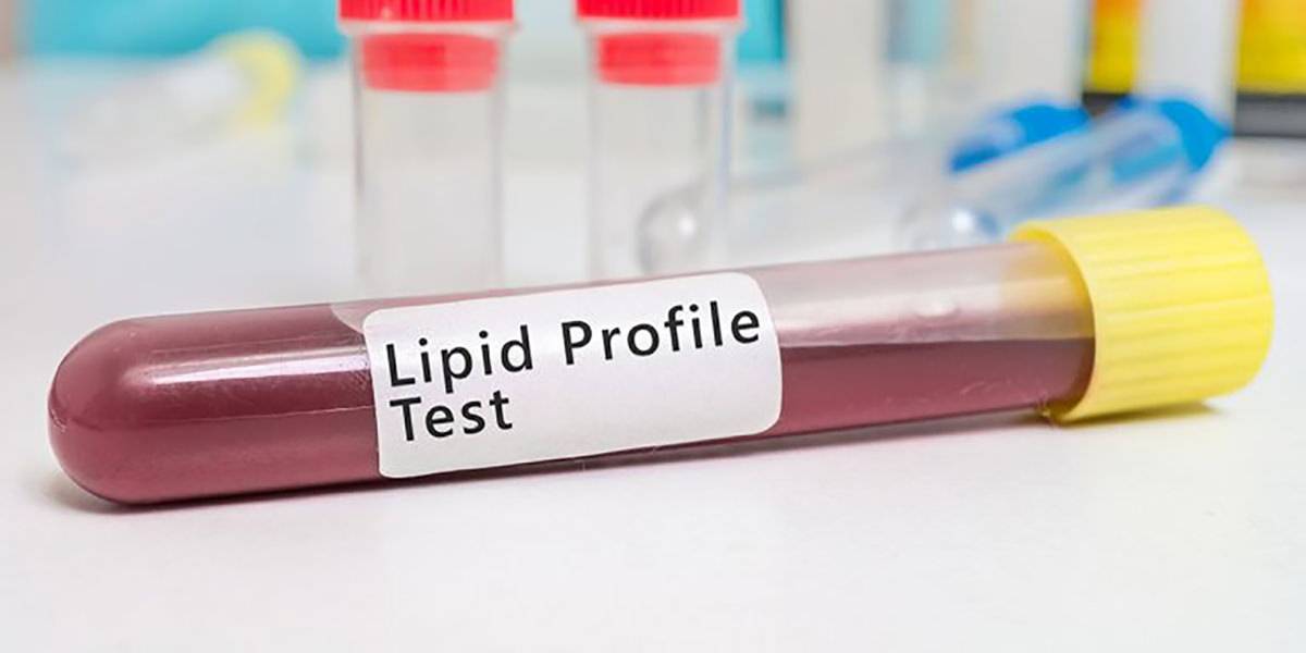 Profilo lipidico: colesterolo e trigliceridi