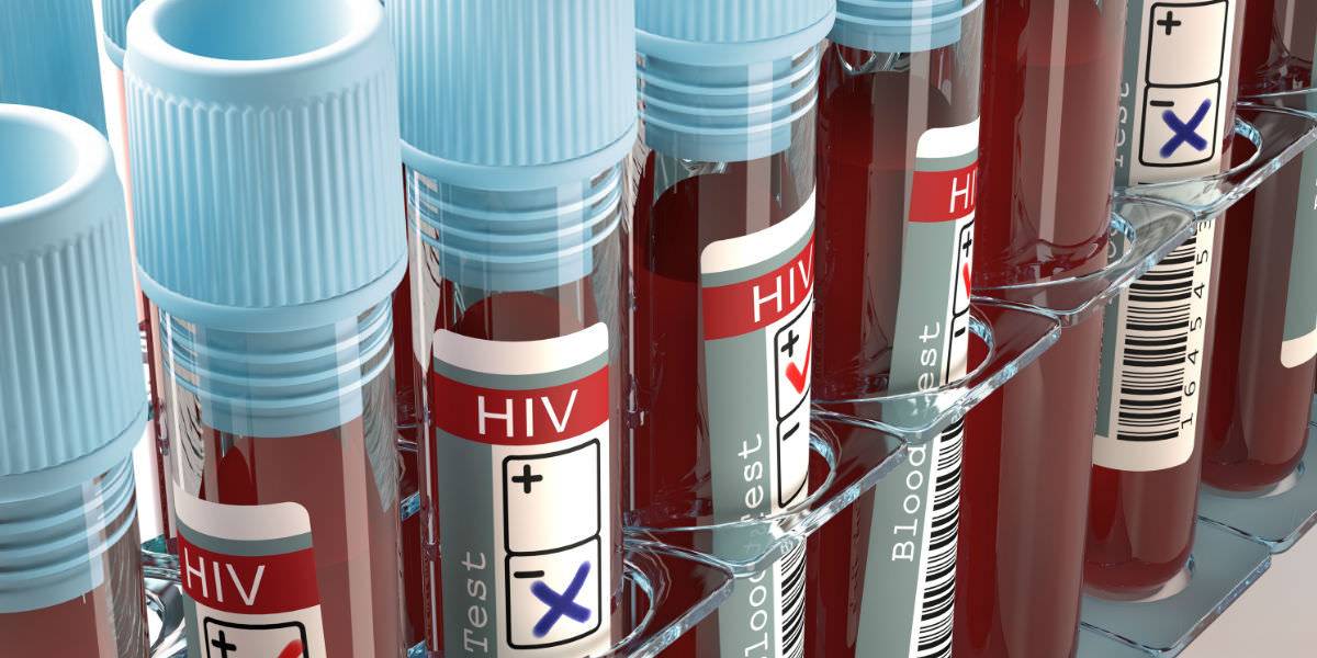 Autotest per HIV