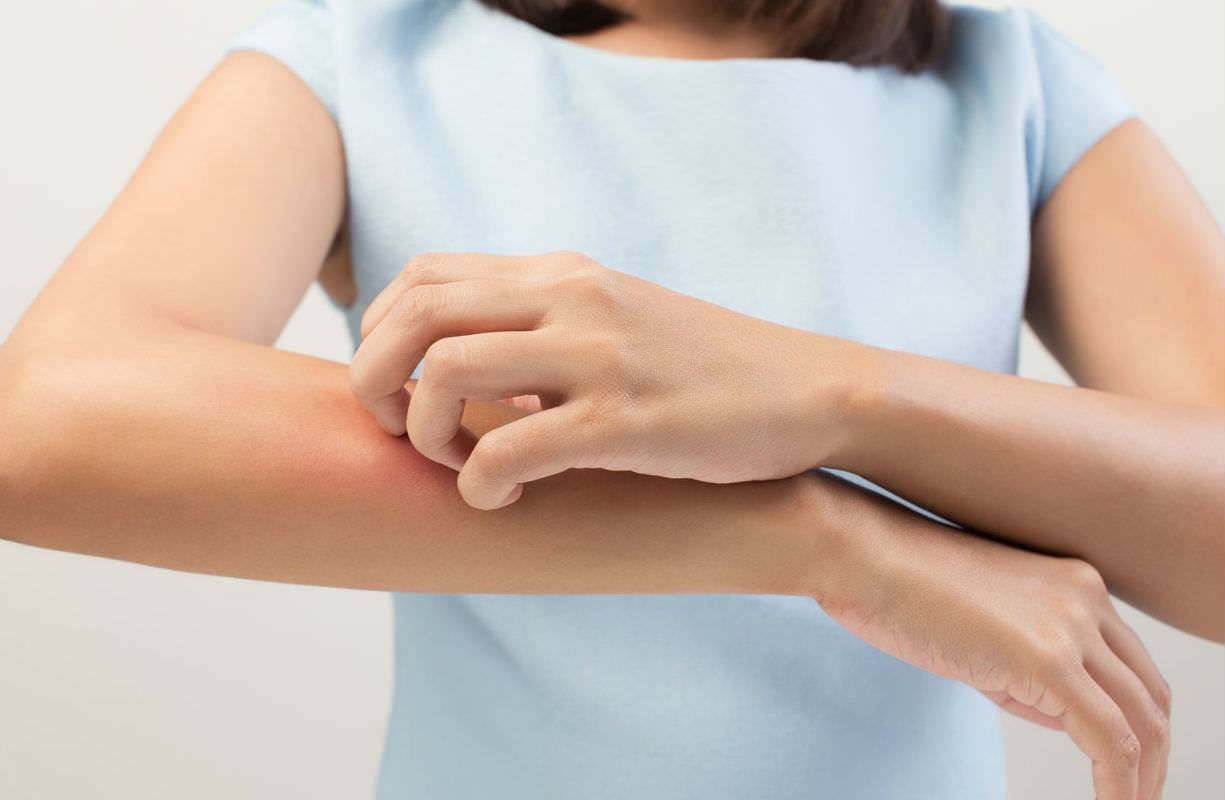 Quali sono le cause della dermatite allergica e come si cura