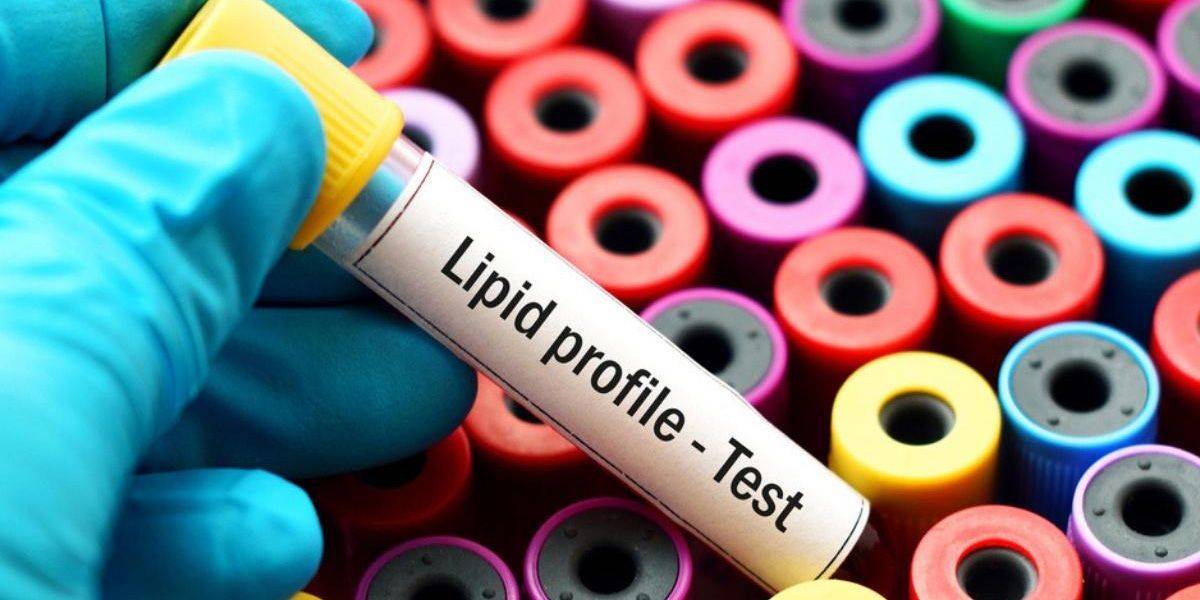 Test per il profilo lipidico