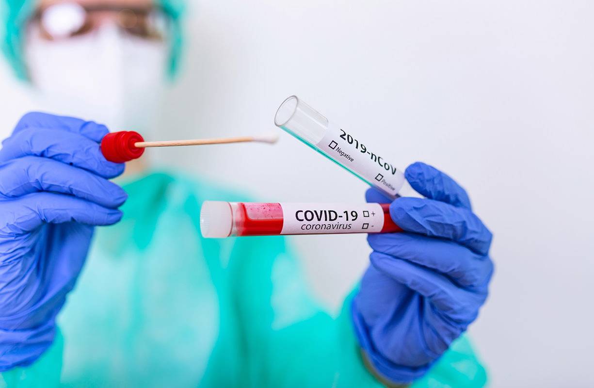 Test per  il covid-19 : molecolari, antigenici e sierologici